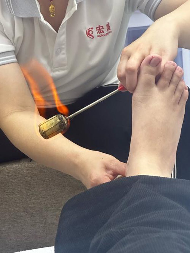 足底按摩